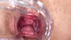Vaginal Folds [7 marca 2022] - screenshot from the video #6