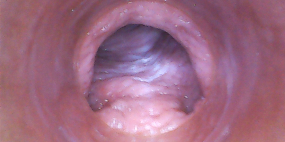 RAW endoscopic video - intro photo