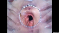 RAW endoscopic video [8. února 2016] - screenshot from the video #5