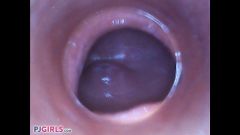 RAW Endoscopic Video [26. ledna 2017] - screenshot from the video #2