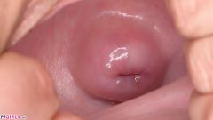 Cervix Everywhere You Look [May 2, 2018] - screenshot from the video #5