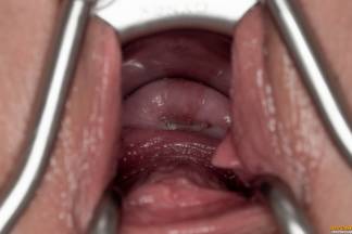 Speculum in Motion [17 mars 2020] - asdisloren007_p.jpg