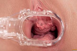 Speculum in Motion [17 mars 2020] - asdisloren011_p.jpg