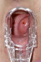Juicy hole [8. Dezember 2014] - emily014_p.jpg