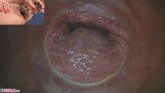 Raw Endoscopic Bonus [17 maja 2020] - screenshot from the video #3