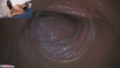 Raw Endoscopic Bonus [17 maja 2020] - screenshot from the video #4