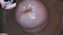 Raw Endoscopic Bonus [17 maja 2020] - screenshot from the video #5