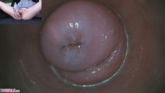 Raw Endoscopic Bonus [17 maja 2020] - screenshot from the video #6
