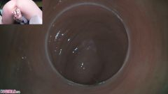 Raw Endoscopic Bonus [17 maja 2020] - screenshot from the video #7