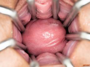 Exposed Teen Pussy [31 mars 2026] - merysecret009_p.jpg