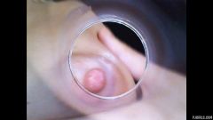 RAW endoscopic video [23. března 2016] - screenshot from the video #2