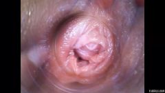 RAW endoscopic video [29. května 2016] - screenshot from the video #2