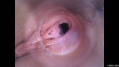 RAW endoscopic video [11. října 2015] - screenshot from the video #2