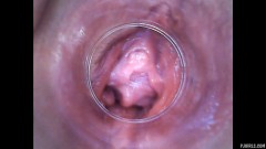 RAW endoscopic video [8. února 2016] - screenshot from the video #3