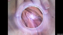 RAW endoscopic video [23. března 2016] - screenshot from the video #3