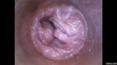 RAW endoscopic video [17. července 2016] - screenshot from the video #3