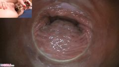 Raw Endoscopic Bonus [17 maja 2020] - screenshot from the video #10