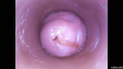RAW endoscopic video [4. března 2016] - screenshot from the video #4