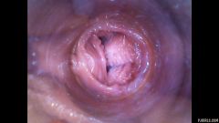 RAW endoscopic video [29. května 2016] - screenshot from the video #4