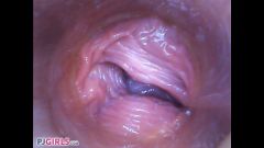 RAW Endoscopic Video [26 de enero de 2017] - screenshot from the video #4
