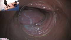 Raw Endoscopic Bonus [17 maja 2020] - screenshot from the video #11