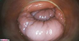 Bonus With Acabella [26 de outubro de 2025] - screenshot from the video #4