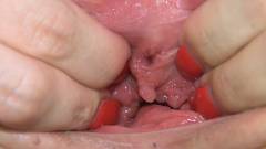 Split hole [4 de maio de 2014] - screenshot from the video #4