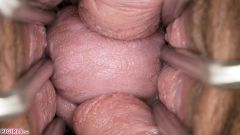 Vaginal Folds Everywhere [5 novembre 2025] - screenshot from the video #5