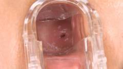 Speculum only [27 de junio de 2014] - screenshot from the video #5
