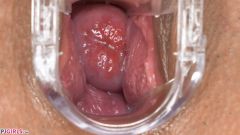 Gyno Play [25. listopadu 2019] - screenshot from the video #6