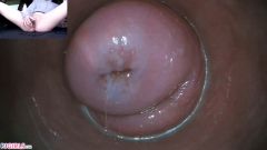 Raw Endoscopic Bonus [17 maja 2020] - screenshot from the video #13