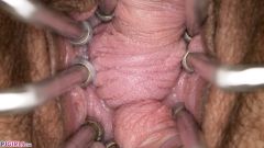 Vaginal Folds Everywhere [5 novembre 2025] - screenshot from the video #6