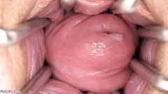 Exposed Teen Pussy [25 marca 2026] - screenshot from the video #6