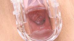 Mature vagina [2014年7月30日] - screenshot from the video #6