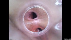 RAW endoscopic video [8. února 2016] - screenshot from the video #7