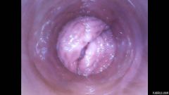 RAW endoscopic video [4. března 2016] - screenshot from the video #7