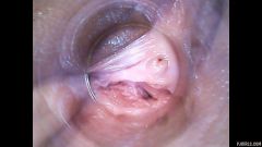 RAW endoscopic video [29. května 2016] - screenshot from the video #7