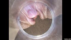 RAW endoscopic video [17. července 2016] - screenshot from the video #7