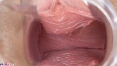 Gyno Play [25. listopadu 2019] - screenshot from the video #7