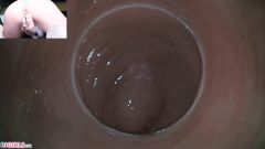 Raw Endoscopic Bonus [17 maja 2020] - screenshot from the video #14