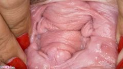 Vaginal Folds Everywhere [5 novembre 2025] - screenshot from the video #7