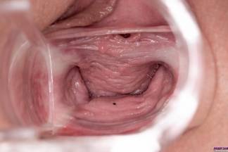Speculum in Motion [17. Dezember 2020] - sydneylove012_p.jpg