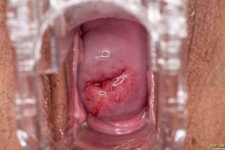 Meaty Pussy Anterior [15 juillet 2021] - tinytina013_p.jpg