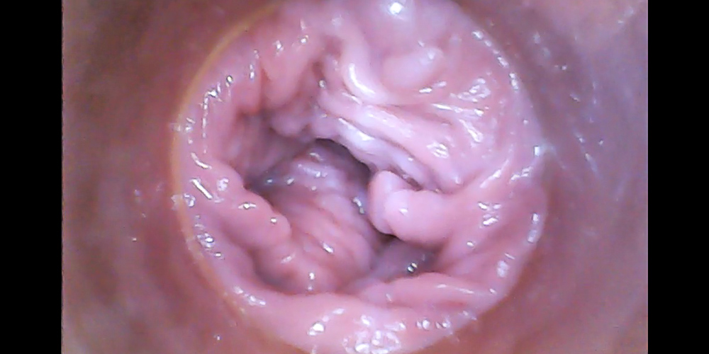 RAW endoscopic video - intro photo