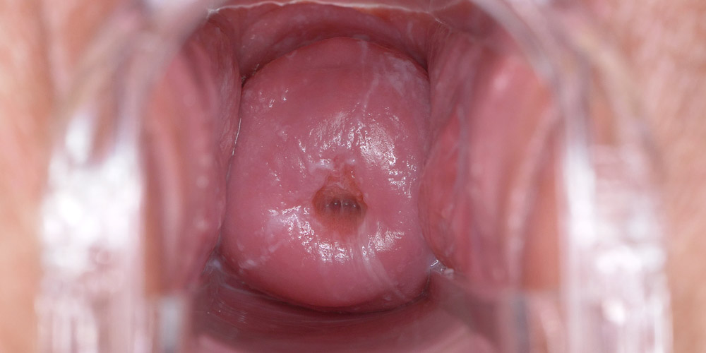 Crushing Contractions - intro photo