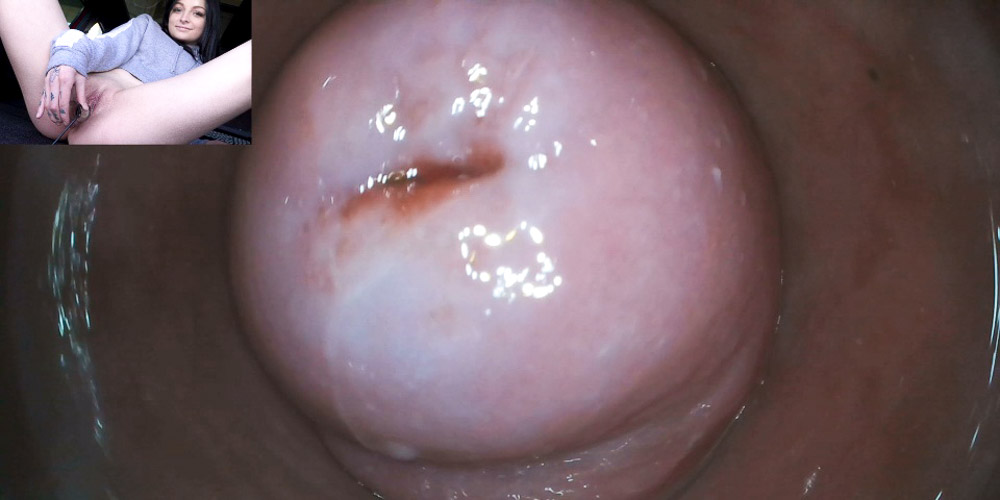 Raw Endoscopic Bonus - intro photo