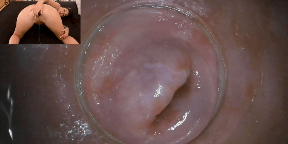 RAW endoscopic video - intro photo