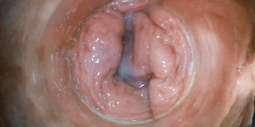 RAW Endoscopic Video - intro photo