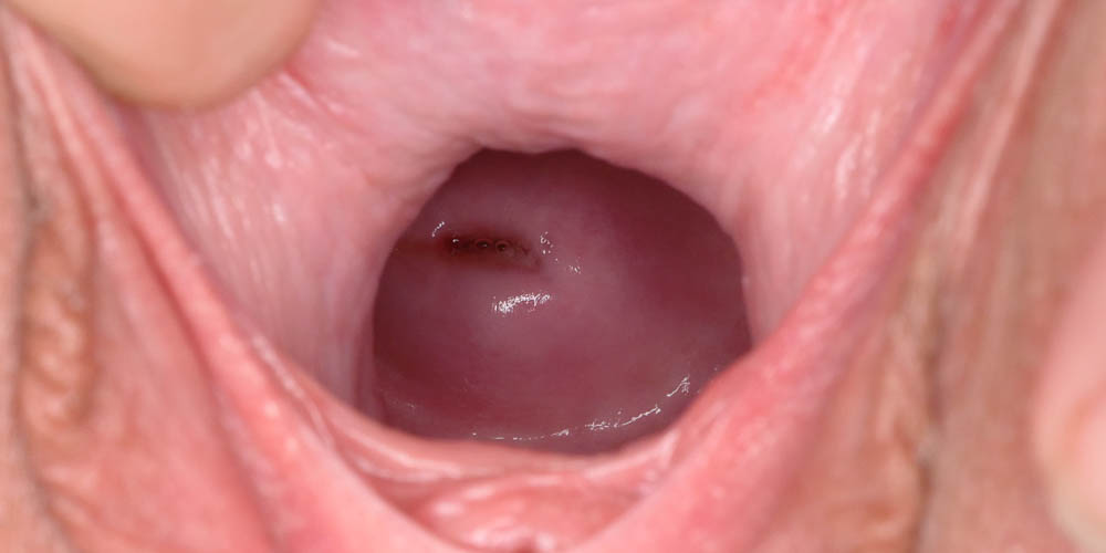 Pure Gaping - intro photo