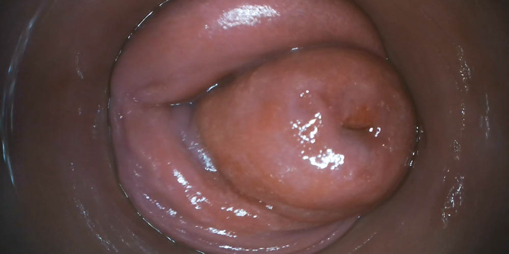 Bonus With Acabella - intro photo